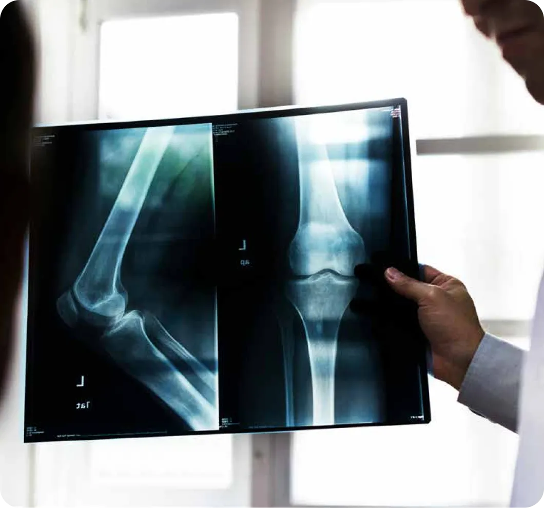 Consultant reviewing a knee X-ray